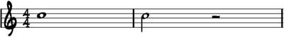 ligadura musical